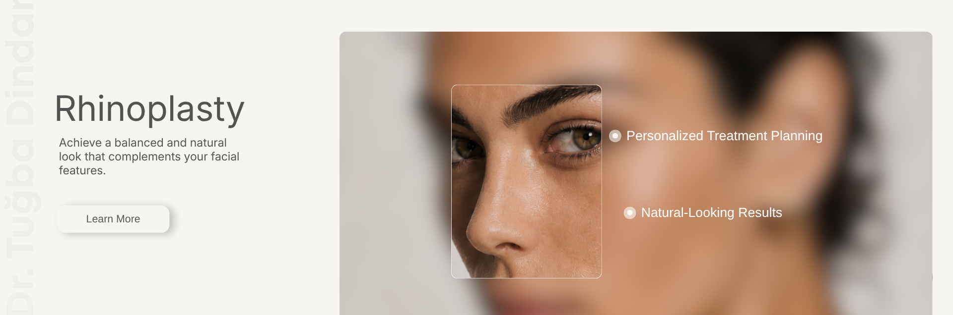 Rhinoplasty