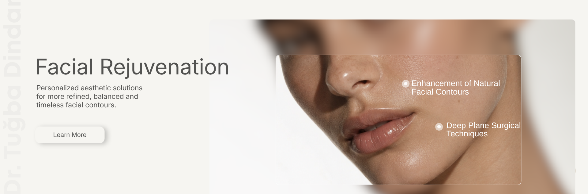 Facelift Surgery