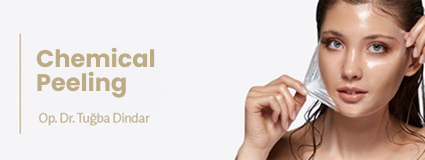Chemical Peeling