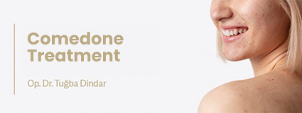 Comedone Treatment