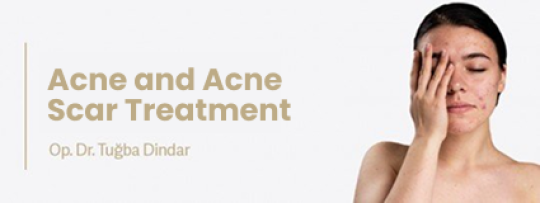 Acne & Acne Scar Treatment