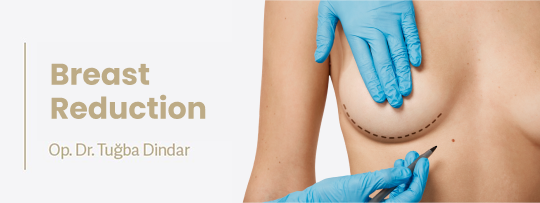 Breast Reduction