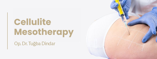 Cellulite Mesotherapy