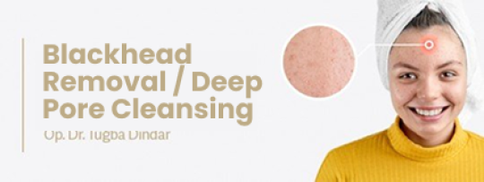 Blackhead Removal