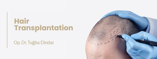 Hair Transplant