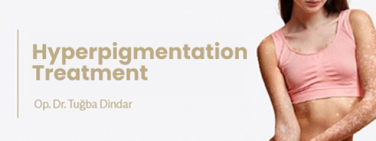 Hyperpigmentation Treatment