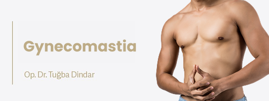 Gynecomastia