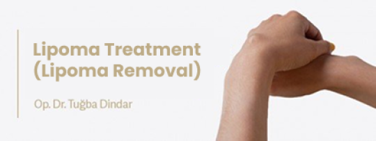 Lipoma Treatment & Lipoma Removal