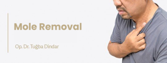 Mole Removal