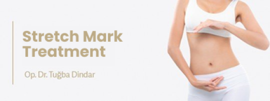 Stretch Mark Treatment