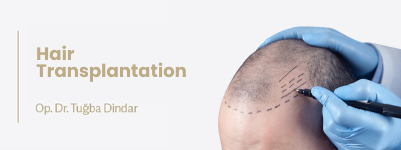 Hair Transplant