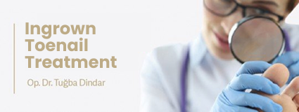 Ingrown Toenail Treatment