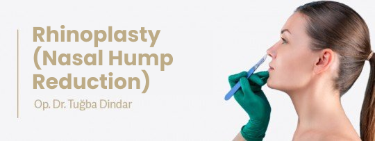 Nasal Hump Reduction Surgery (Nose Bridge Rasping)