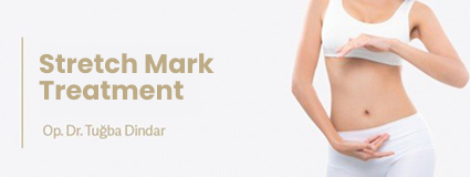 Stretch Mark Treatment